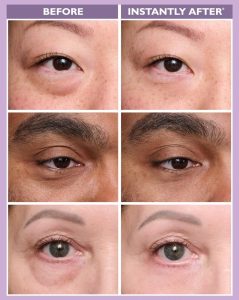 Peter Thomas Roth Instant FIRMx Eye Before And After Results
